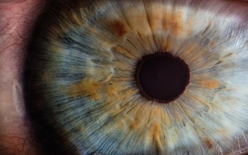 What is Iridology