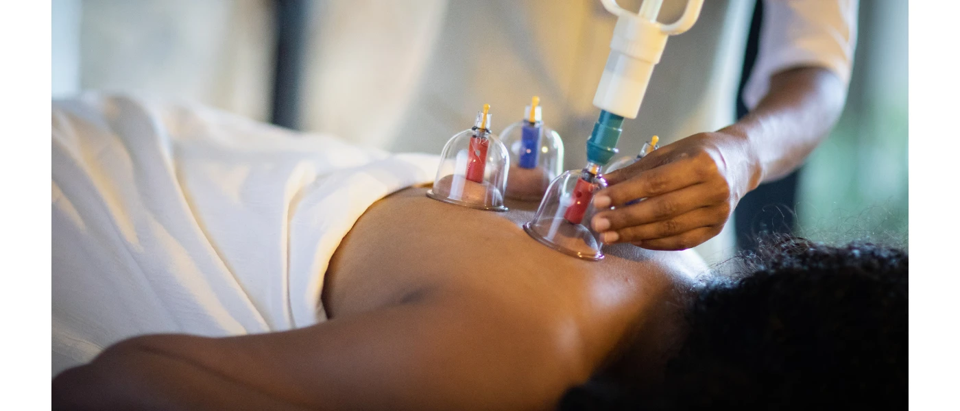 Woman lies on her front on a bed as a therapist carries out cupping therapy on her back