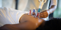 Woman lies on her front on a bed as a therapist carries out cupping therapy on her back